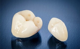 two dental crowns in Reno (for What Is a Dental Crown? Section)