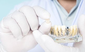 Reno implant dentist holding restoration and model teeth