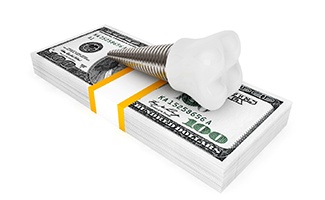 Cost of dental implants in Reno represented by model dental implant and money