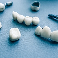 Types of dental implants in Reno on blue background