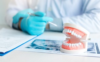 Model of dentures in Reno next to paperwork and X-rays