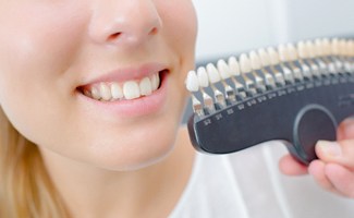 A shade guide being used to match a patient’s tooth color