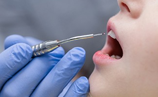 A patient getting laser gum recontouring