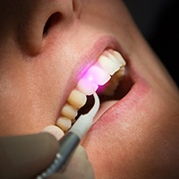 Patient getting laser gum disease treatment