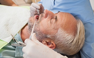 a relaxed person having their teeth cleaned by a hygienist