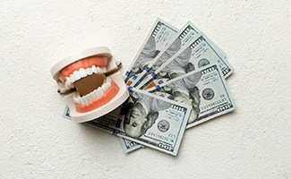 a model of a mouth sitting atop a stack of money