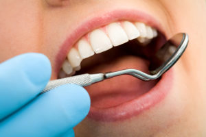 Examining teeth with dental mirror