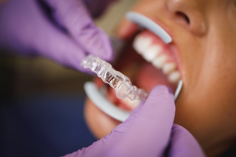 Dentist putting Invisalign trays on patient