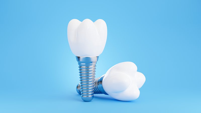 Dental implants from Reno