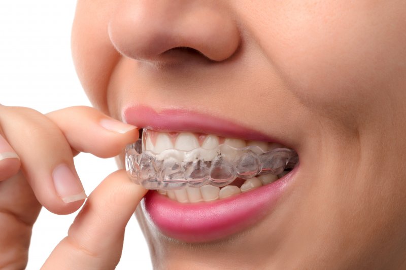 A patient putting in their Invisalign aligner