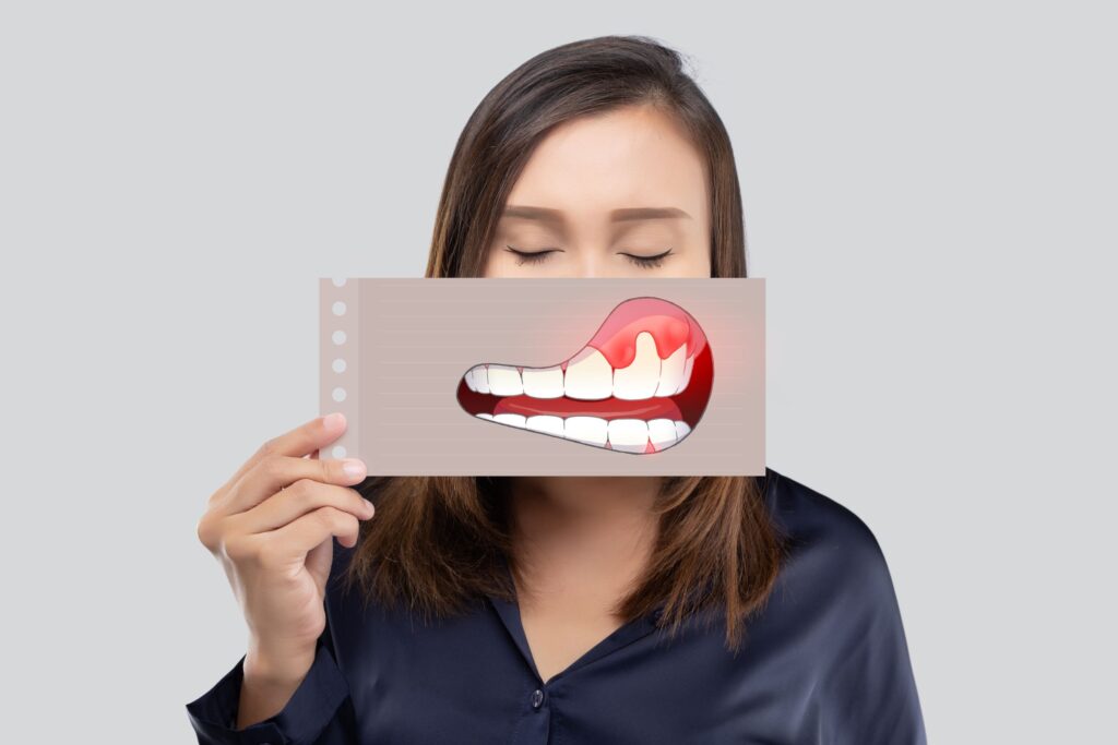 Woman holding illustration of swollen gums in front of her face