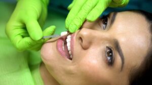 Woman getting veneers. 