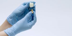 Gloved hands holding a dental implant. 